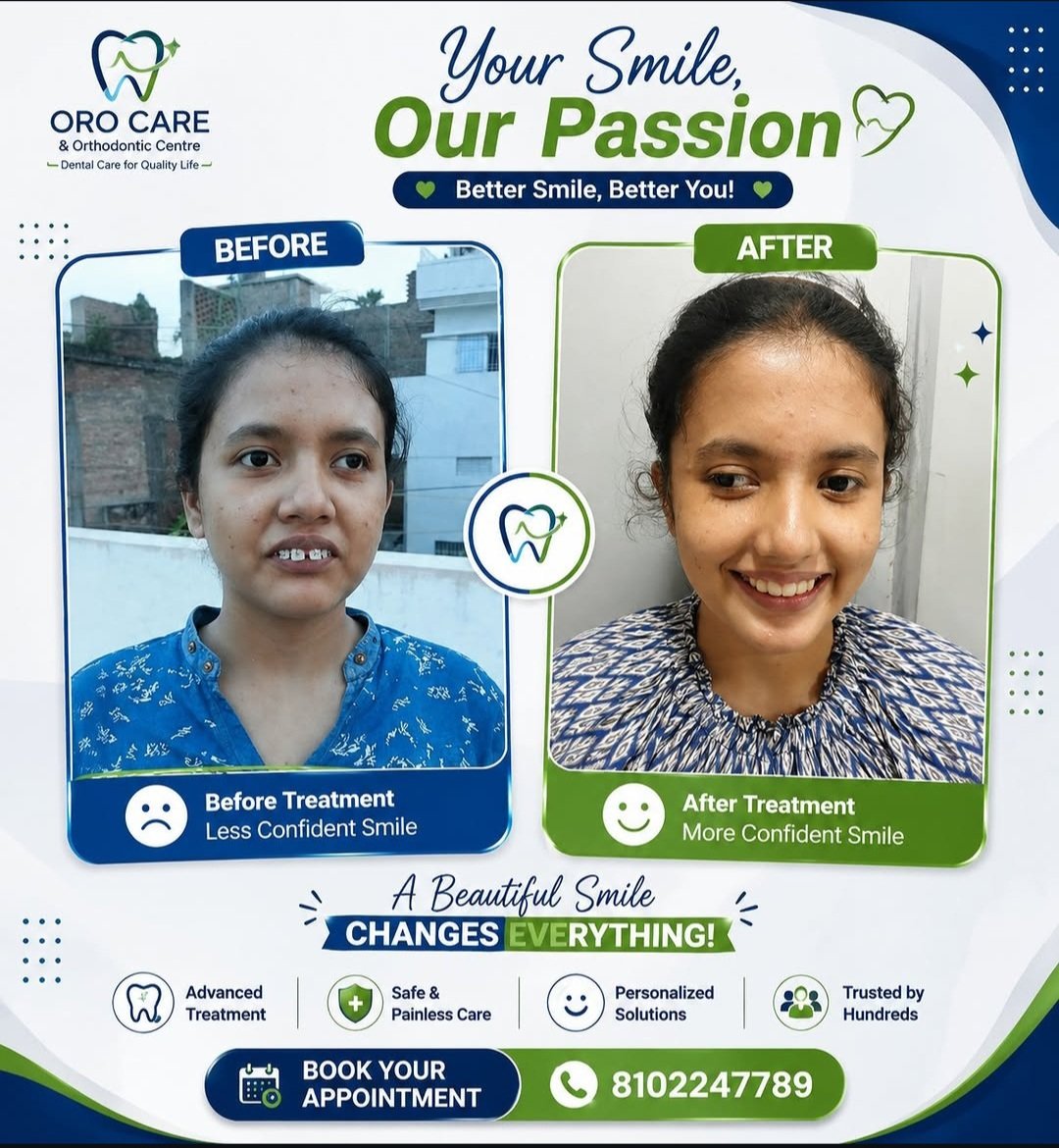 Real patient before and after transformation shared after their treatment at Oro Care