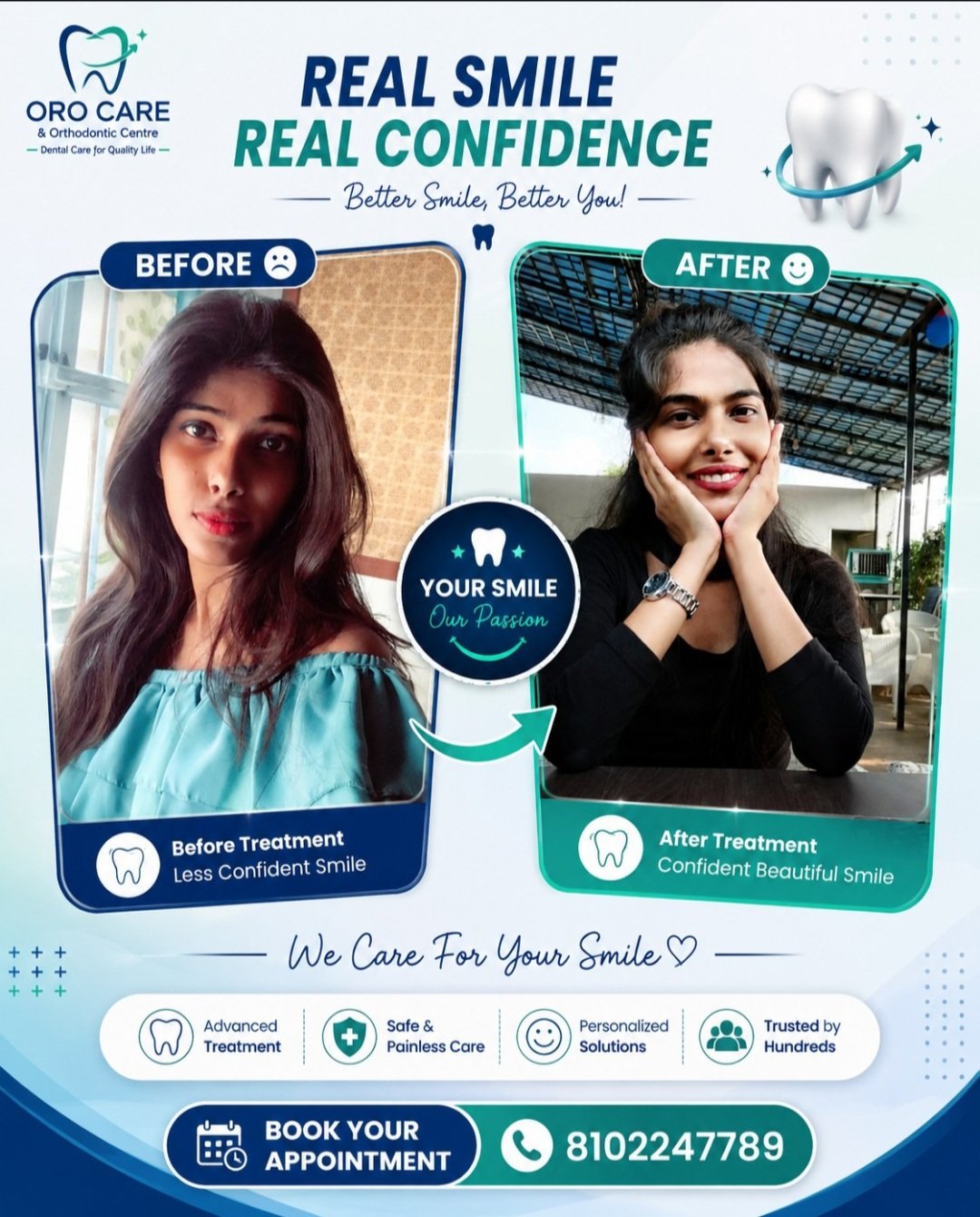 Real patient before and after transformation shared after their treatment at Oro Care