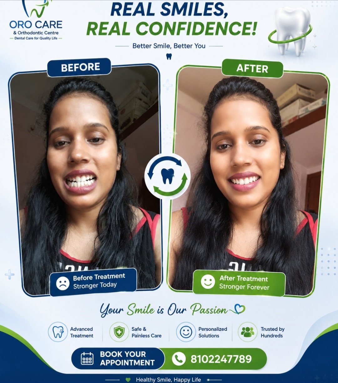 Real patient before and after transformation shared after their treatment at Oro Care