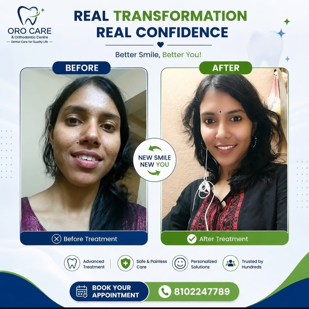 Real patient before and after transformation shared after their treatment at Oro Care